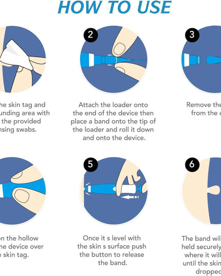 2 in 1 Skin Tag Remover Kit - Painless