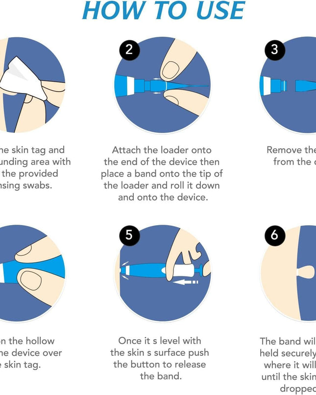 2 in 1 Skin Tag Remover Kit - Painless