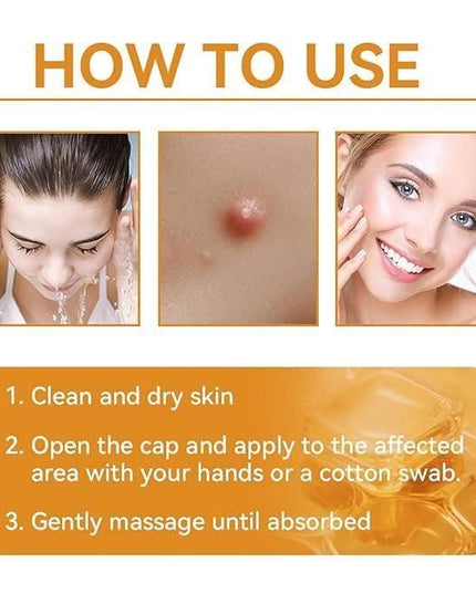 Bee Venom Skin Treatment Cream 100g (Pack of 2)